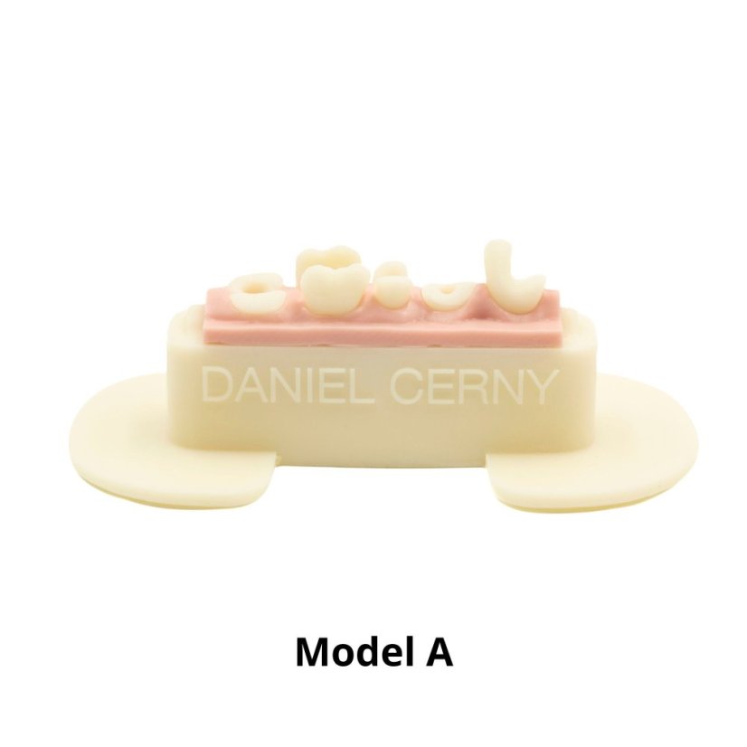 Post-Endo Model - Modelo: Modelo B