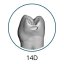 Monomaterial Teeth with Cavities (Biovoxel Typodont) - Elige el diente: 15 Mesio - Occluso - Distal Cavity