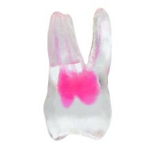 EndoTooth 16 Upper Molar (Less Complex)