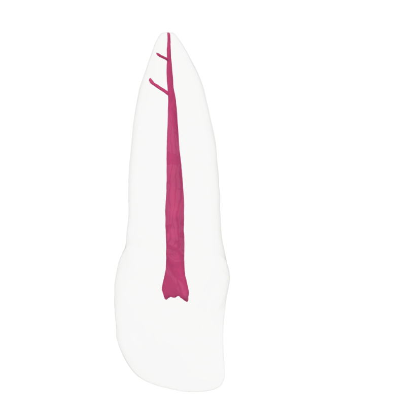EndoTooth 11 Upper Incisor - Transparencia: Transparente, Acceso al diente: Accedido, Pulpa dental: Con pulpa