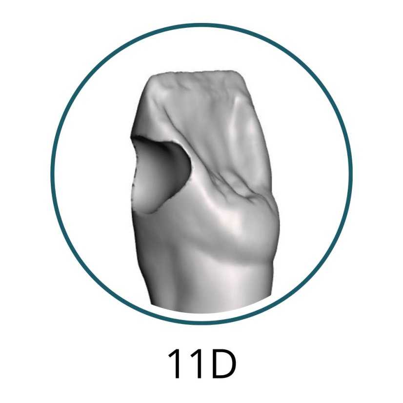 Monomaterial Teeth with Cavities (Biovoxel Typodont) - Zahn wählen: 37 Occlusal Cavity