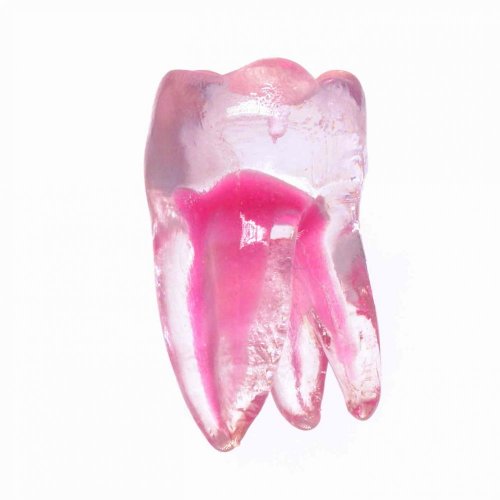 EndoTooth 37 Lower Molar (More Complex) - Tooth Access: Accessed