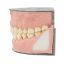Biovoxel Typodont Jaw - Kiefer: Ober- und Unterkiefer, Typodont Type: Periodontal