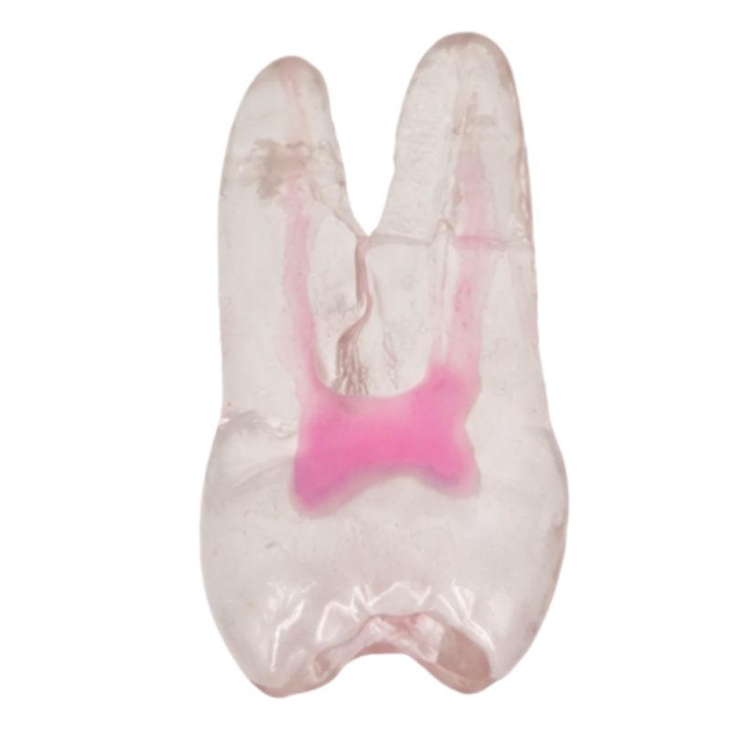 Endotooth 17 Upper Molar (Biovoxel Typodont) - Transparency: Transparent, Tooth Access: Intact, Non-Accessed, Pulp: With pulp