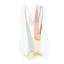 Re-Endotooth 26 (Biovoxel Typodont) - Transparency: Transparent