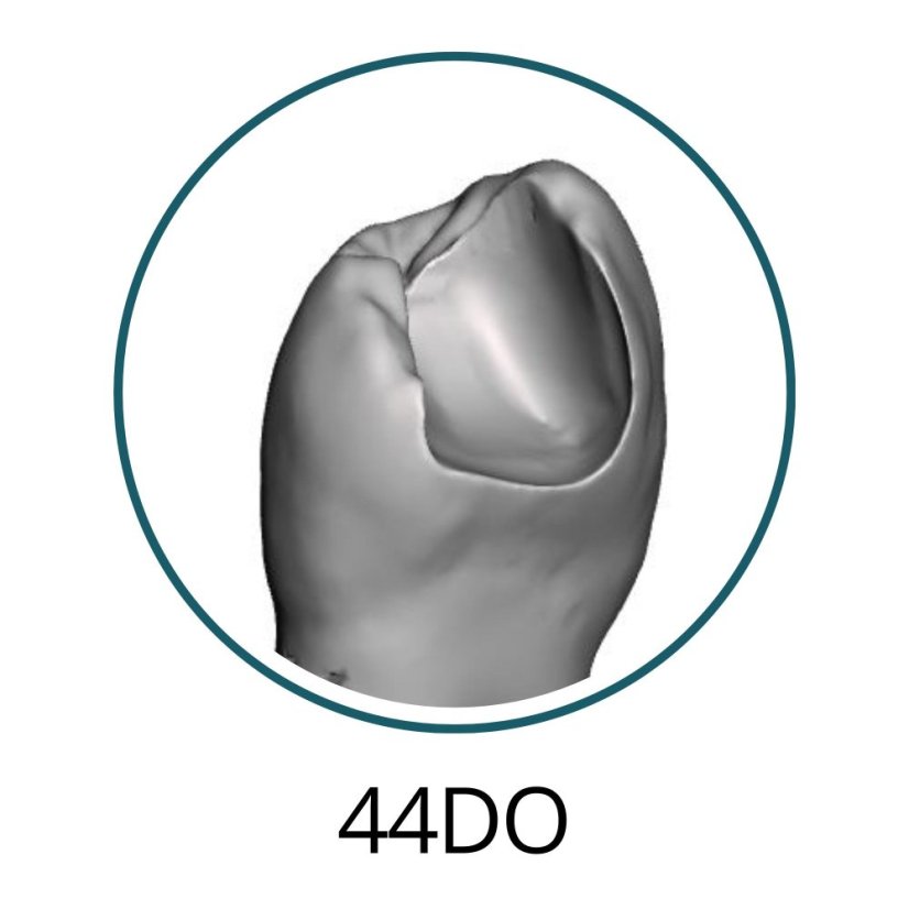 Monomaterial Teeth with Cavities (Biovoxel Typodont) - Elige el diente: 15 Mesio - Occluso - Distal Cavity