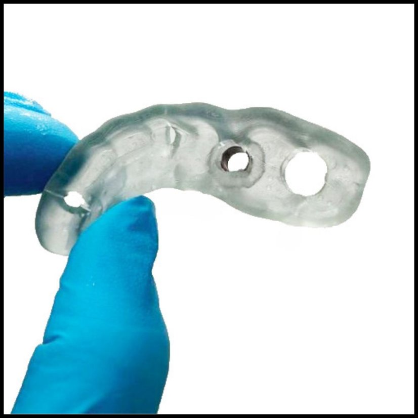 Surgical Implant Guide