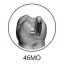 Monomaterial Teeth with Cavities (Biovoxel Typodont) - Elige el diente: 15 Mesio - Occluso - Distal Cavity