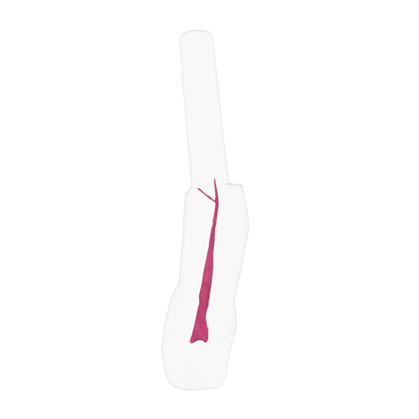 EndoTooth 11 Central Incisor (KaVo Analog)