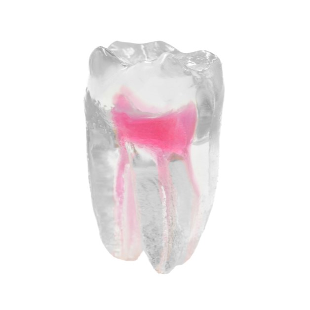EndoTooth 36 Lower Molar (Less Complex) - Transparencia: Transparente, Acceso al diente: Intacto, no accedido