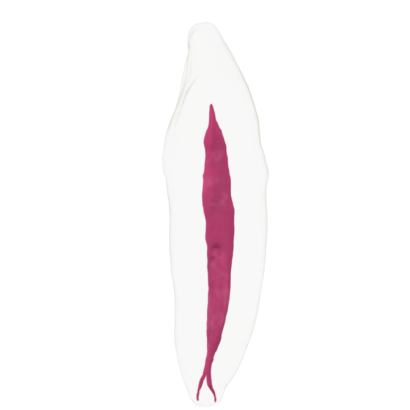 EndoTooth 43 Lower Canine - Transparency: Opaque, Tooth Access: Accessed, Pulp: Without the pulp