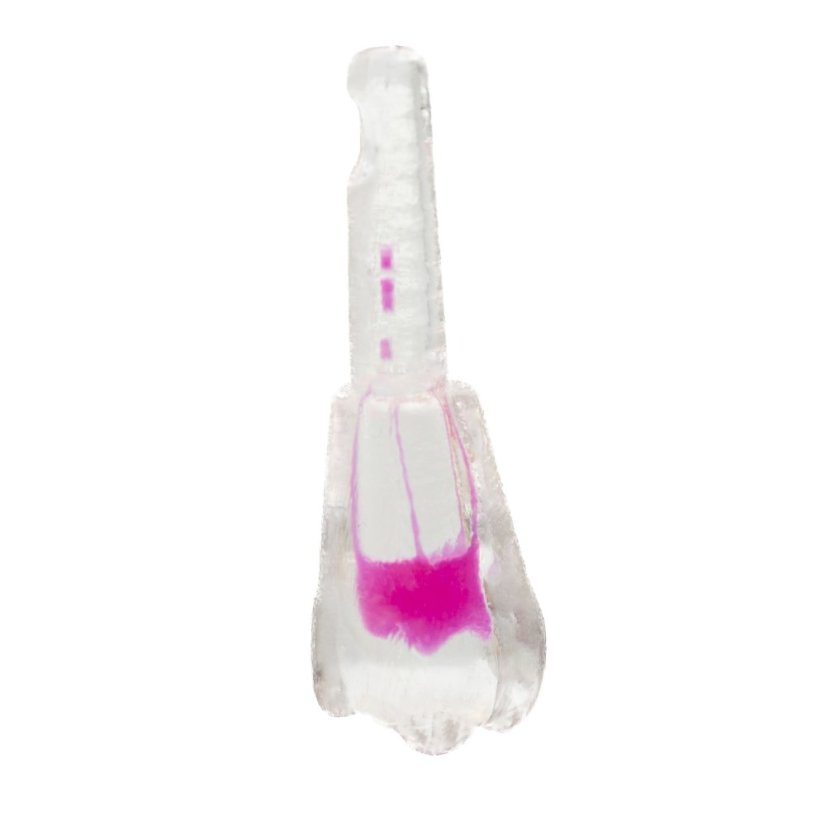 EndoTooth 16 Upper Molar - Less Complex (KaVo Analog)