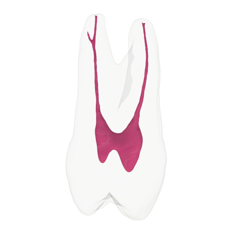 EndoTooth 24 Upper Premolar