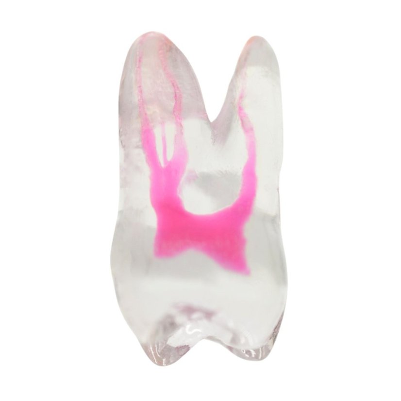 Endotooth 16 Upper Molar (Biovoxel Typodont) - Priehladnosť: Priehľadný, Trepanácia: Trepanovaný, Zubná dreň: S dreňou