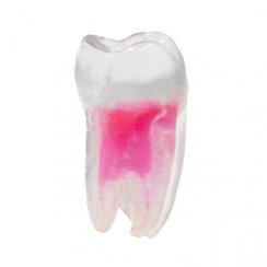 EndoTooth 37 Lower Molar (More Complex)