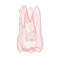 Endotooth 17 Upper Molar (Biovoxel Typodont)