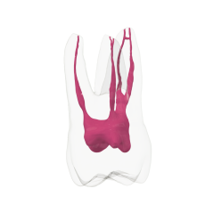 EndoTooth 16 Upper Molar (More Complex)