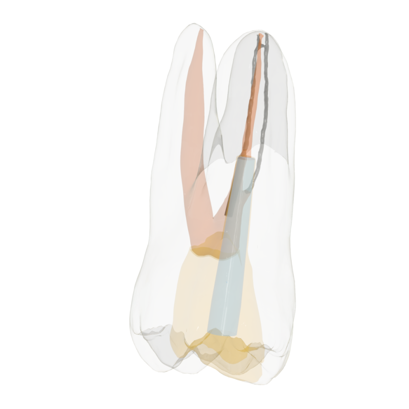 Re-Endotooth 26 (Biovoxel Typodont) - Transparency: Transparent