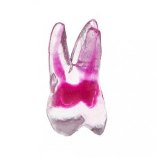 EndoTooth 16 Upper Molar (More Complex)