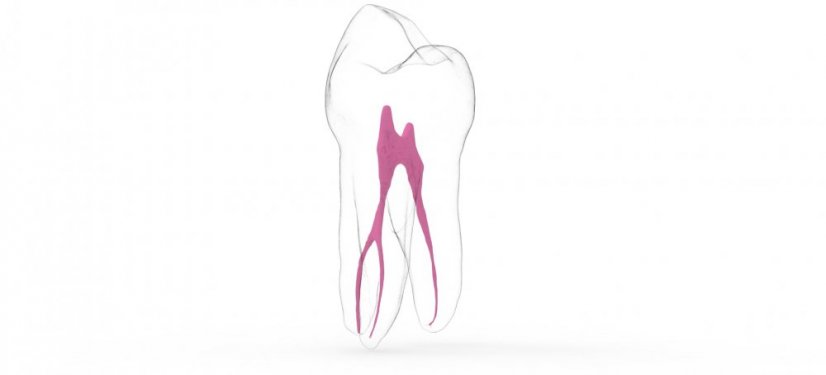 EndoTooth 14 Upper Premolar - Priehladnosť: Nepriehladný, Trepanácia: Intaktný, netrepanovaný, Zubná dreň: S dreňou