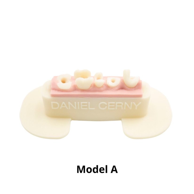 Post-Endo Model