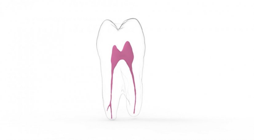 EndoTooth 24 Upper Premolar - Tooth Access: Intact, Non-Accessed, Pulp: With pulpal tissue