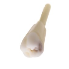 CariesTooth 16 (KaVo Analog)