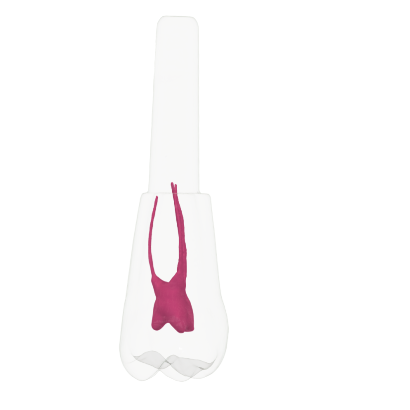 EndoTooth 16 Upper Molar - Less Complex (KaVo Analog)