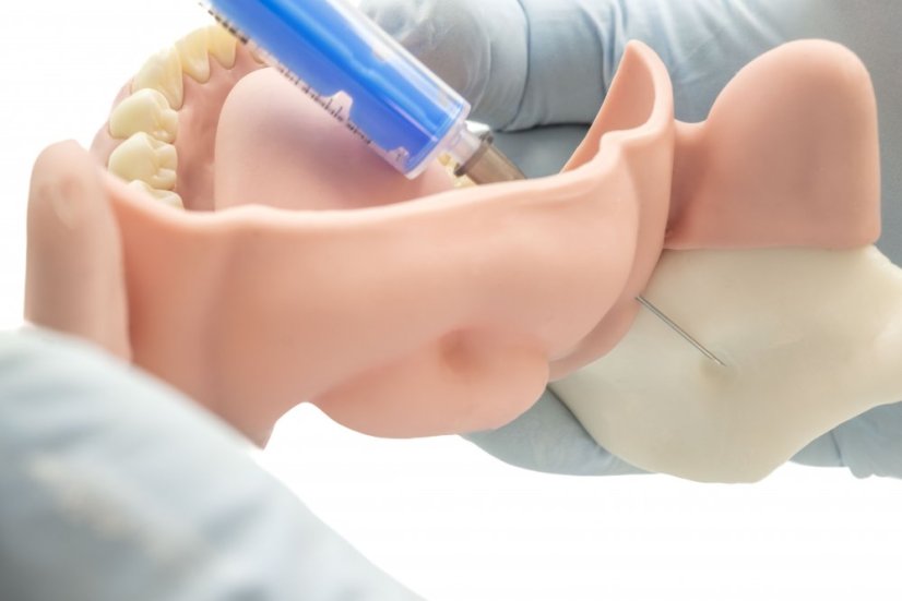Mandibular Anesthesia Model