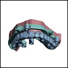 GUÍAS QUIRÚRGICAS + IMPRESIÓN 3D