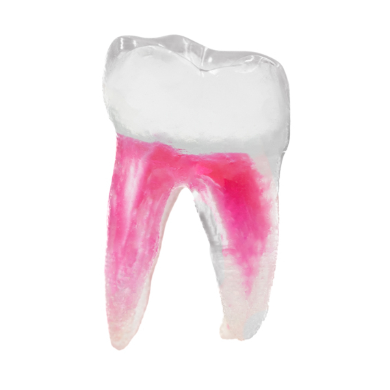EndoTooth 37 Lower Molar (More Complex)