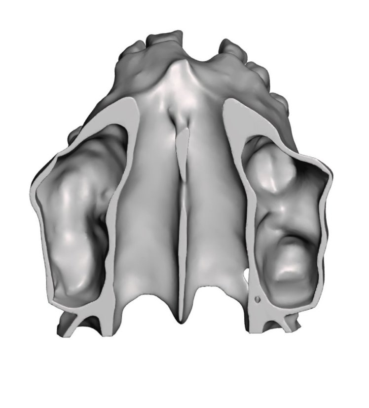 Surgical Training Jaw Model