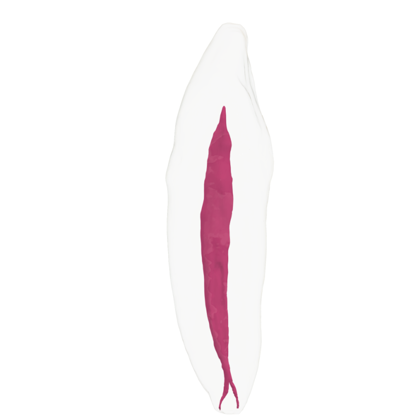 EndoTooth 43 Lower Canine - Transparency: Opaque, Tooth Access: Accessed, Pulp: Without the pulp