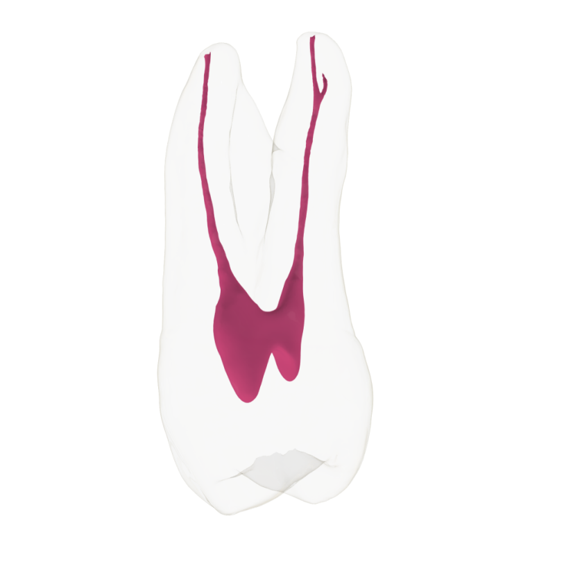 EndoTooth 24 Upper Premolar