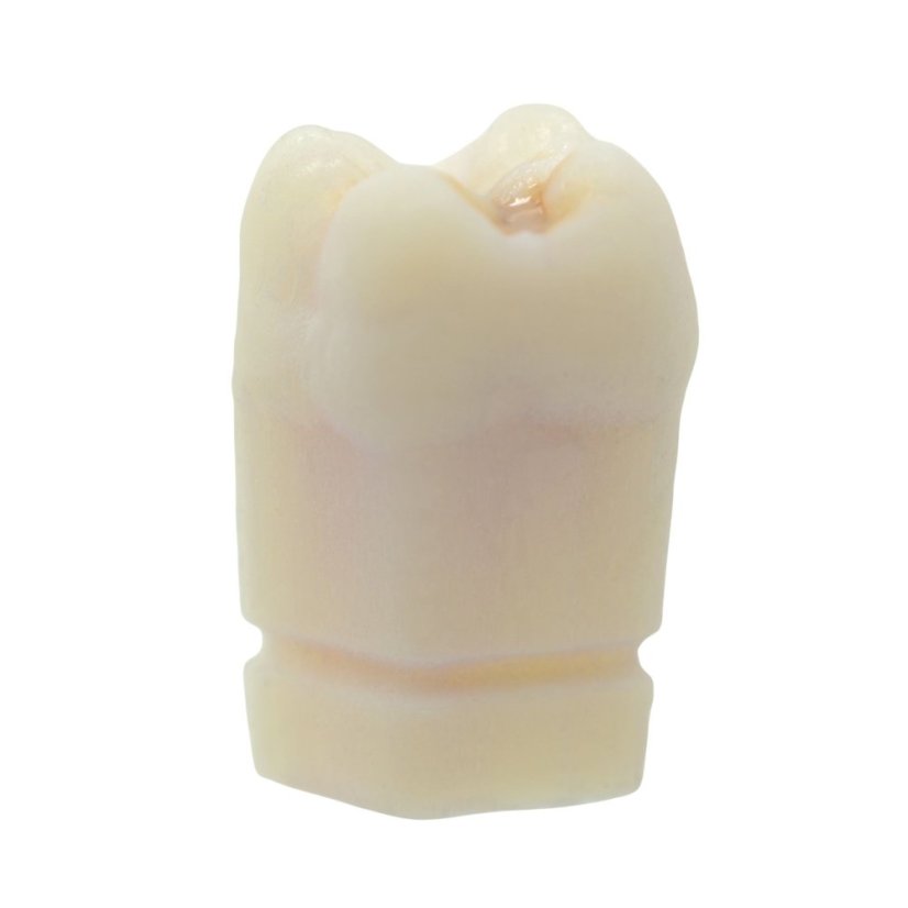 Opaque Endotooth 16 with Occlusal Caries (P-Oclusal)