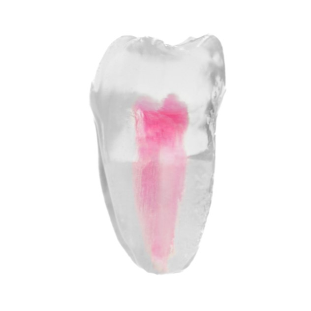 EndoTooth 36 Lower Molar (Less Complex) - Transparencia: Transparente, Acceso al diente: Intacto, no accedido