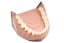 Biovoxel Typodont Jaw - Kiefer: Ober- und Unterkiefer, Typodont Type: Periodontal