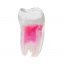 EndoTooth 37 Lower Molar (More Complex) - Tooth Access: Intact, Non-Accessed, Pulp: With pulpal tissue
