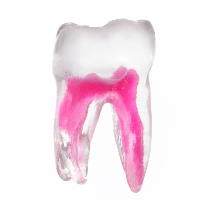 EndoTooth 37 Lower Molar (More Complex)